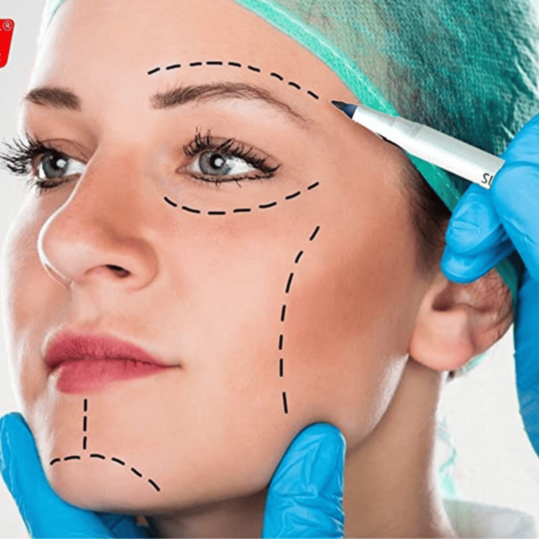 Surgical Skin Markers application