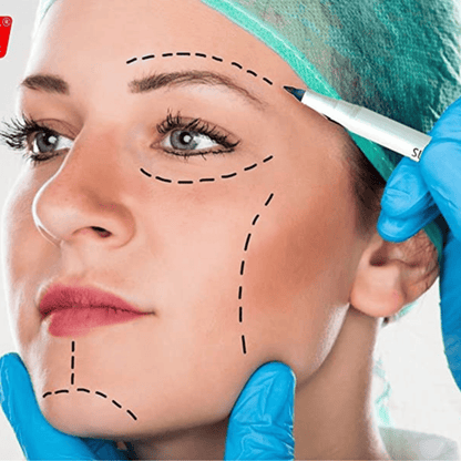 Surgical Skin Markers application