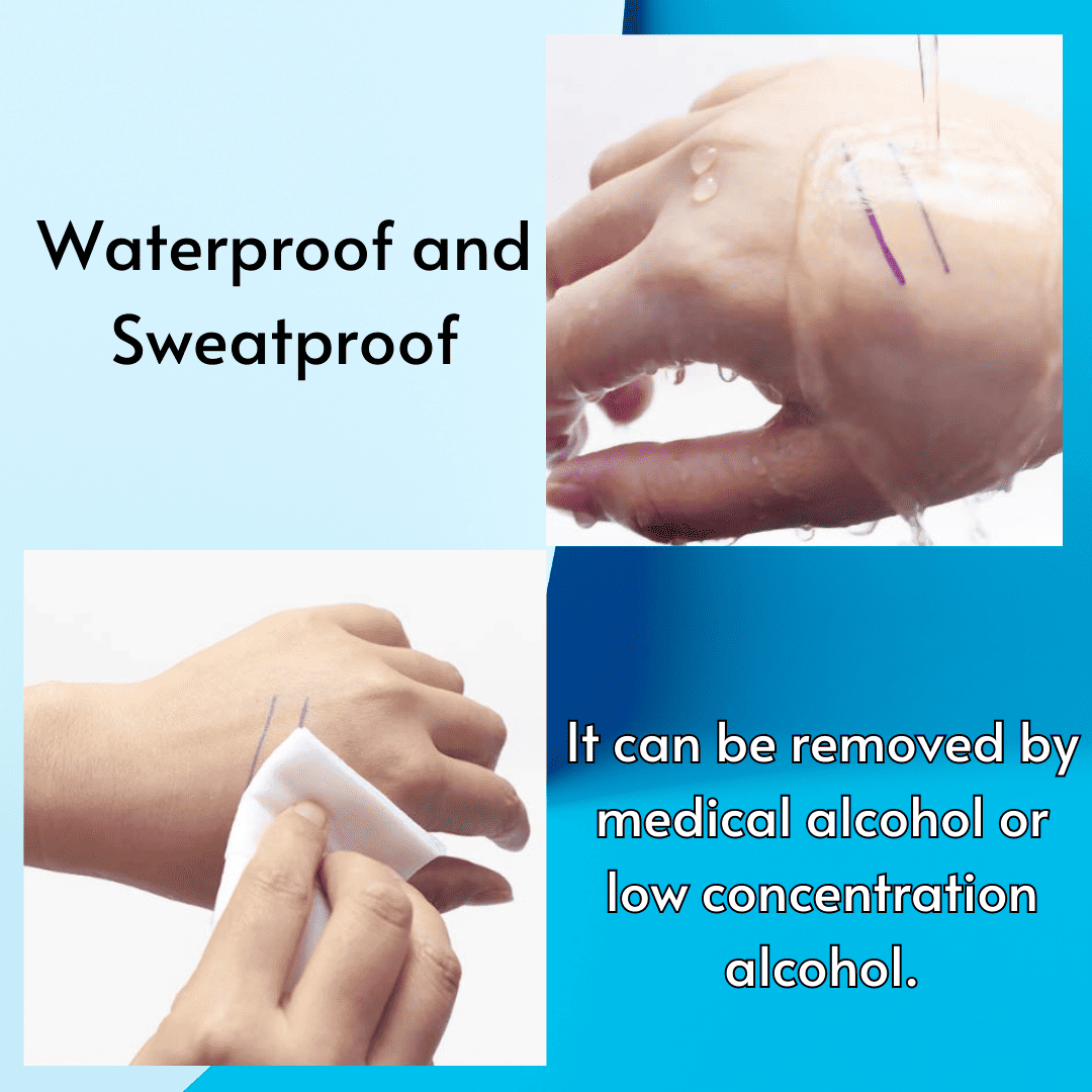 Surgical Skin Markers remove